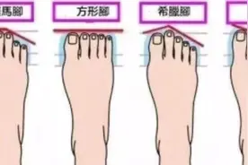 “脚型”一般分为四种，第二种脚型又称为“美人脚”，穿鞋最好看图片