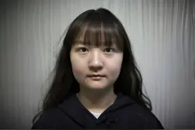 25岁韩国女子整容手术全过程，花费1700万韩元，整成"网红脸"图片