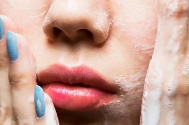 去粉刺毛囊炎痤疮鸡皮身体乳