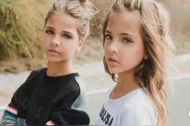 高颜值双胞胎被赞“复制了天使的外表”，出生时医生护士爱不释手图片