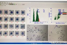 细胞DNA倍体分析 助力癌症筛查图片