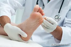 得了足部湿疹，别让脚丫子苦不堪言图片