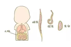 夏季儿童感染虫病高发，如何有效打虫？图片