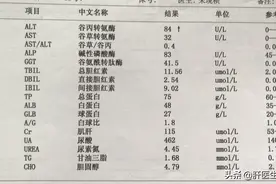 乙肝严不严重，不止要检查乙肝两对半，你还需要了解这些图片
