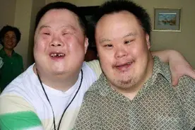 为啥"唐氏儿"都长着同一张脸？医生一般不说，父母最好要知道图片