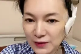 54岁"金花婆婆"就医！做全麻手术切囊肿，有气无力还要赶工作图片