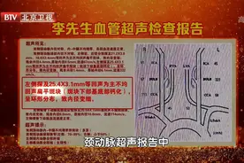 颈部血管一侧粗一侧细，竟隐藏脑卒中危机！几大典型症状别忽视图片
