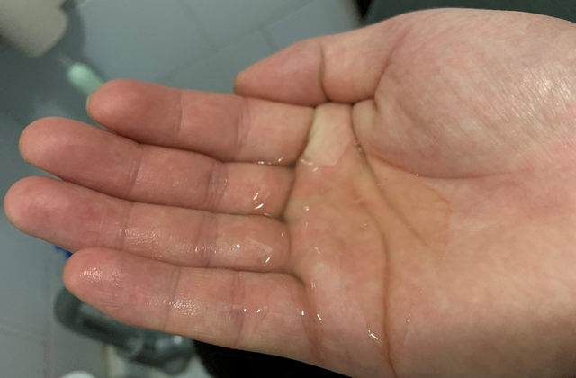 骞寸粓鐩樼偣锛?4娆剧敺澹帶娌逛繚婀夸釜鎶ゅソ鐗╋紝鐢ㄨ繃鎵嶆帹鑽愮郴鍒? onerror=