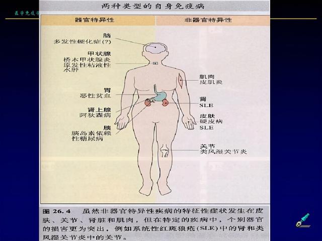 地方性甲状腺肿大主要原因是碘缺乏，会导致甲状腺癌，气管软化等