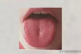 阴虚内热怎么办？有了这两味中药，助你养阴生津，清热凉血图片