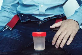 做精液检查，采精程序是怎样的？图片