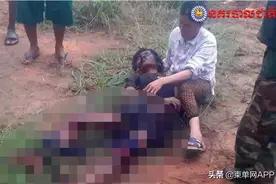 柬埔寨14岁男孩误踩地雷，致双腿严重炸伤图片