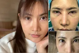 美女整形的博弈：贪图1分的完美，却输掉99分的自己，值得吗？图片