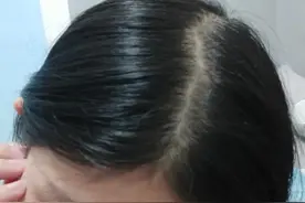 比单身更可怕的，是秃头！学会按摩式清洗头皮，拒做“秃头”少女图片