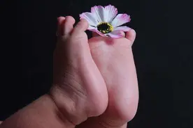 平足治疗，越早越好图片