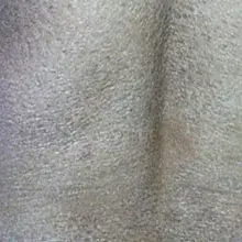 鱼鳞病发病年龄