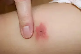 刚入夏就受席虫骚扰？不妨换一床好打理的冰丝席、彩藤席吧图片