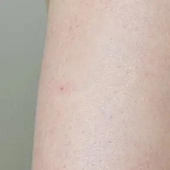 野脚鸡皮肤穿裙子 野脚鸡皮肤穿裙子