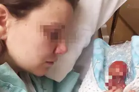 全世界“最小的新生儿”，圆珠笔一样大，网友称：真是一个奇迹图片
