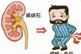 男性肾结石的症状跟女性肾结石的症状其实是不一样的，要注意区分图片