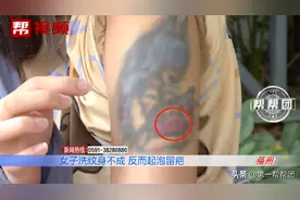 洗纹身后皮肤起泡流脓留疤，私人工作室却称是正常现象？图片