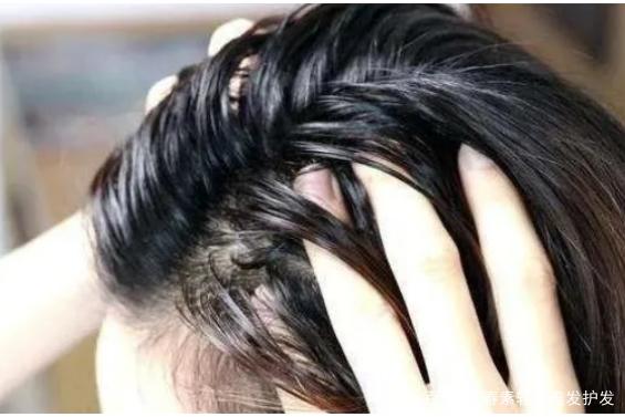 昨晚才洗的头，今天早上就油油腻腻不能见人了？