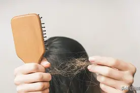 动静健康｜医生告诉你：防脱生发水、生姜片、气垫梳，哪个真有用？图片