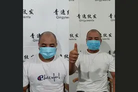 广东秃顶纹发 广州纹发图片
