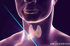 发现甲状腺结节，观察随诊是不是养虎为患？彩超报告揭秘残酷真相图片