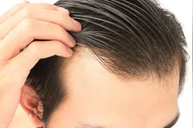 中医：头发病变与内脏状态有何关系？图片