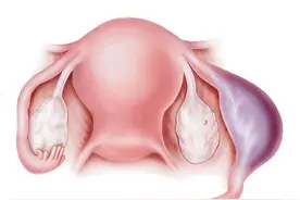 什么是宫外孕，宫外孕的表现症状有哪些？图片