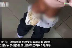 警方证实安徽10岁女孩遭母亲殴打 妇联：父亲也打，已送爷爷奶奶照料图片