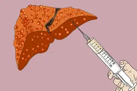 肿瘤医院院长身患肝癌，抗癌15年没复发，总结4点心得，值得学习图片