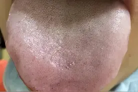 听说七天瘦回初恋脸，结果她瘦出了月经不调图片