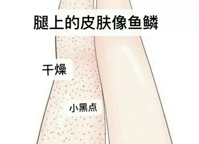 12岁女孩能不能用身体乳