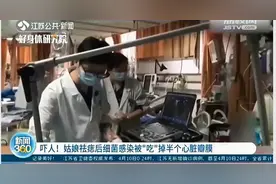 长痣别乱祛图片