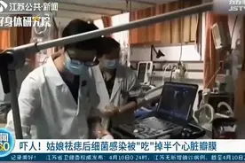 长痣别乱祛图片