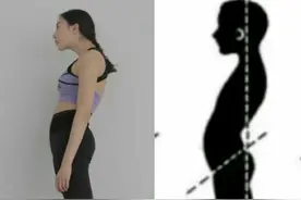 女士产后骨盆矫正的好处和必要性图片