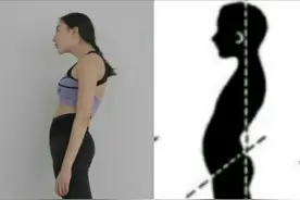 女士产后骨盆矫正的好处和必要性图片