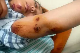 3岁儿子景区小便引冲突，母亲被男子推下20米悬崖？当地派出所：她身体失衡摔下去的图片