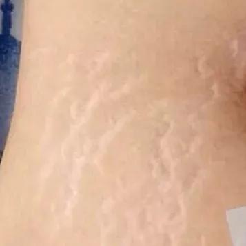 野脚鸡皮肤穿裙子 野脚鸡皮肤穿裙子