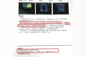 真实案例：是药三分毒？不吃药甲亢真的能自己好吗？图片