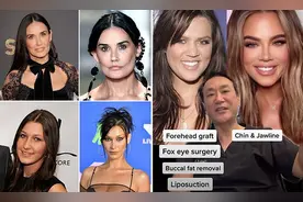 美整形医生走红，拆穿女星天然改变，凯莉·詹娜未来或“小丑脸”图片