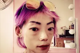 郭永淳前妻伍智恒病情恶化暴瘦仅22公斤，无奈卖收藏品帮补医药费图片
