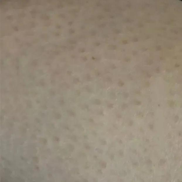 野脚鸡皮肤穿裙子 野脚鸡皮肤穿裙子