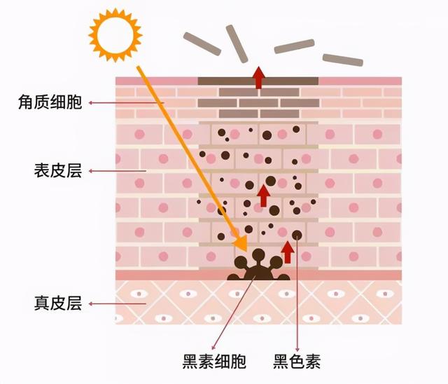 脂溢性角化激光治疗后易复发吗