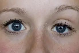 眼睛突然一只大一只小，她被确诊肺癌！这些症状出现，速就医图片