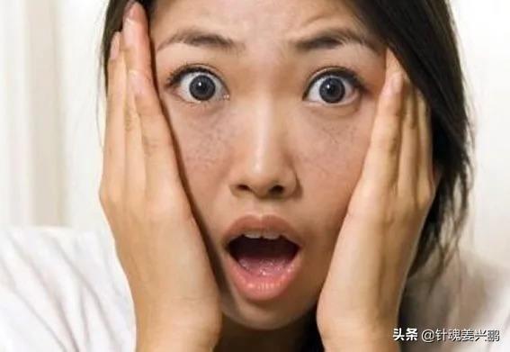 老年脂溢性角化症