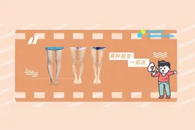 「o型腿」的两种类型，你知道吗？图片