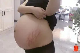 “孕期妊娠纹”都会挑什么人生长？这四类准妈妈易中招，有你吗？图片